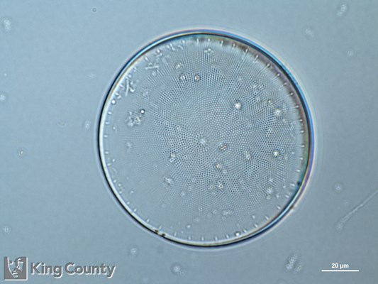 Photo of Coscinodiscus spp.